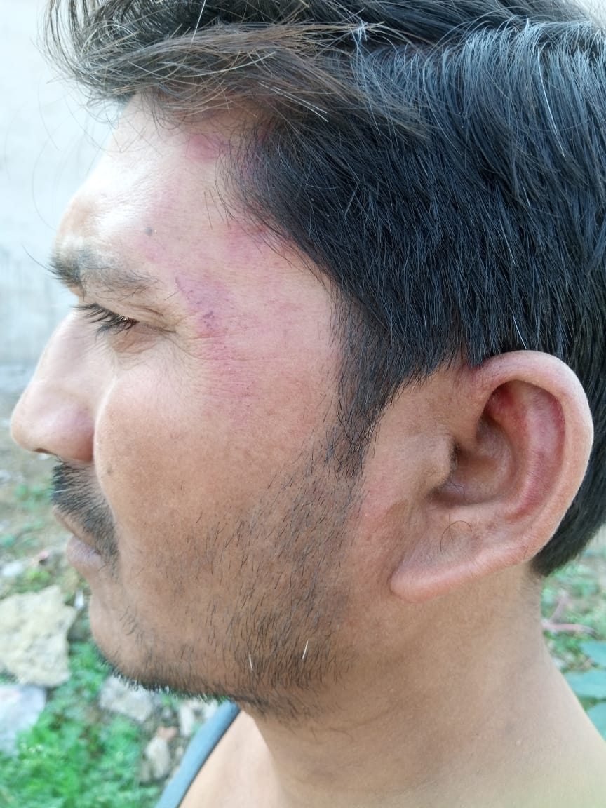 आटा थाना क्षेत्र में दबंगों का दुस्साहस, आपे चालक को सरेशाम लूटकर किया&nbsp;अपहृत