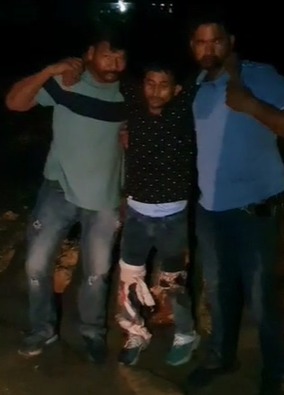 कोतवाली पुलिस ने दो को घायल करके तीन पेशेवर बदमाश&nbsp;पकड़े