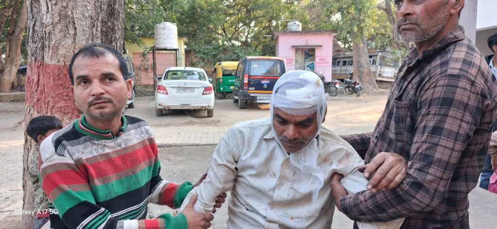 ऊमरी बस स्टैंड पर बवाल: टेंपो चालक ने रोडवेज स्टाफ को पीटा, ₹8 हजार व टिकट गड्डी&nbsp;लूटी!